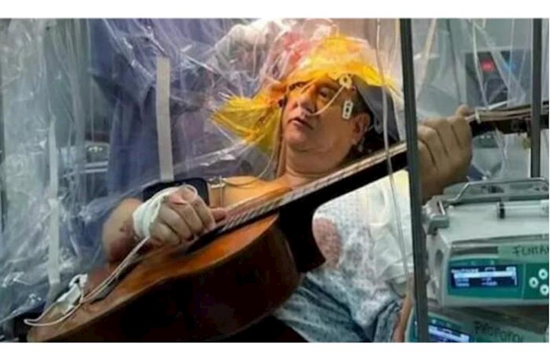 Beyin əməliyyatı zamanı 4 saat gitara ifa etdi — FOTO
