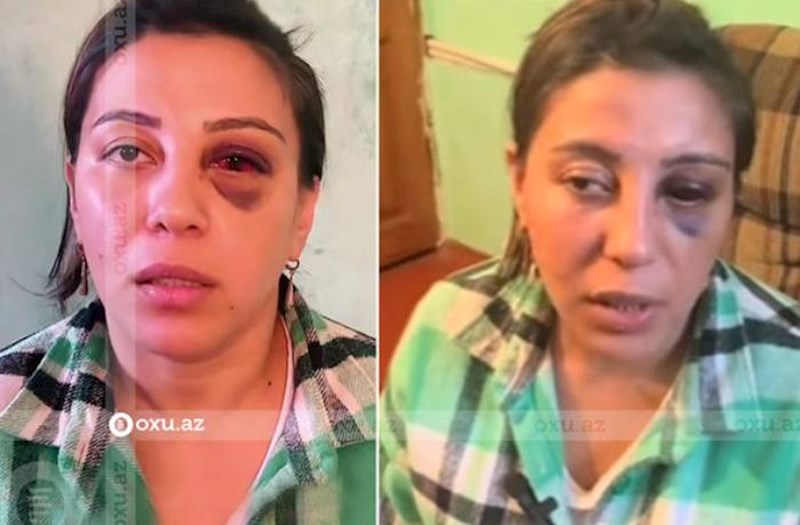 Əri tərəfindən döyülən qadınla bağlı araşdırma başladılıb — VİDEO
